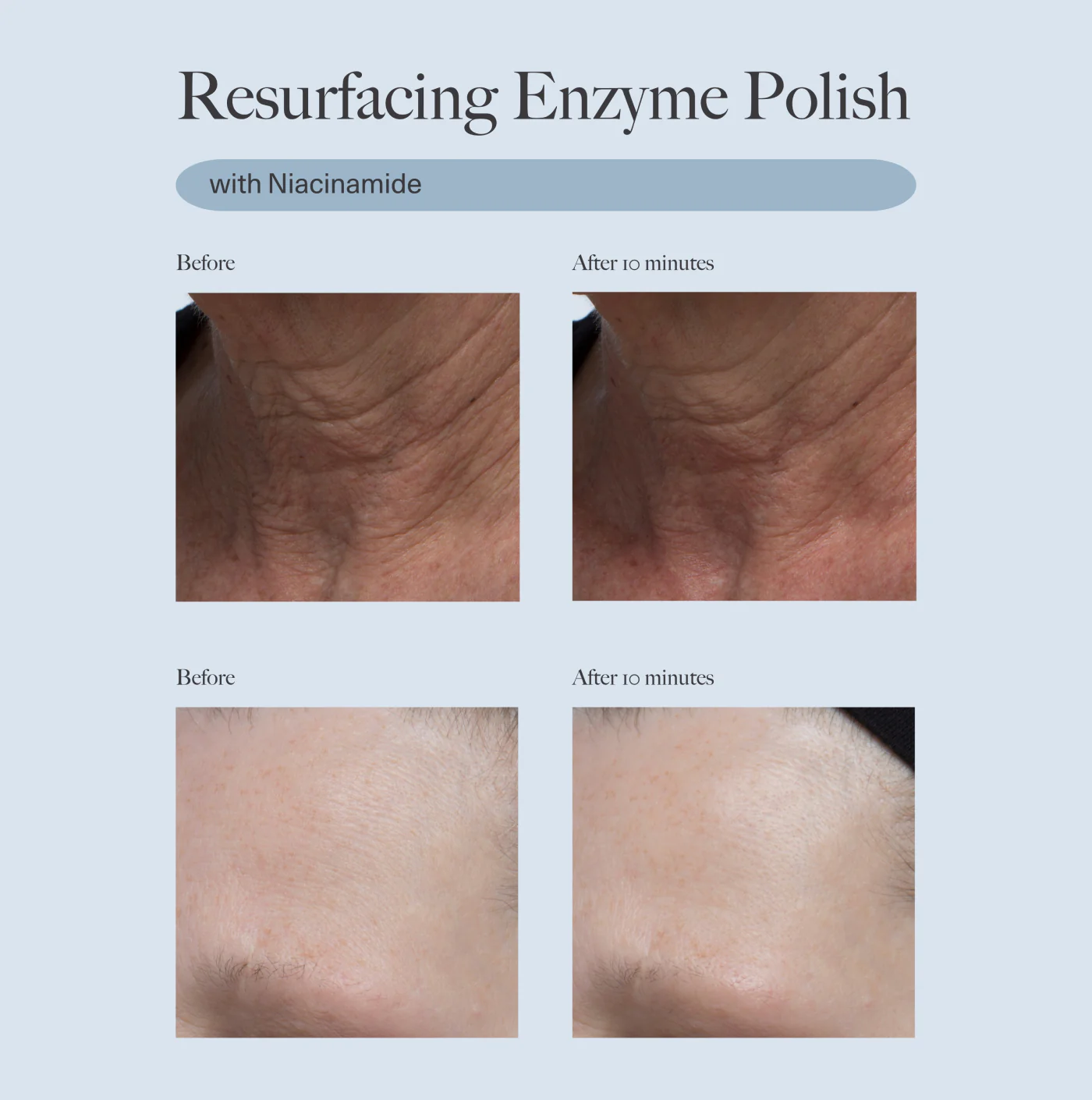 Resurfacing Enzyme Polish - Image 3